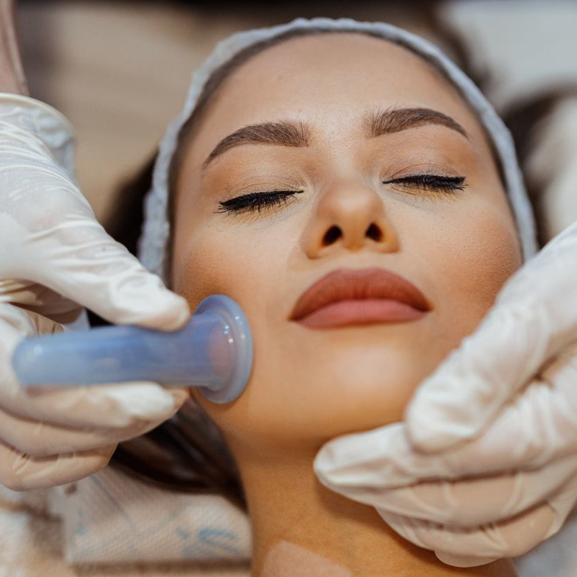 Optie gezichtscupping