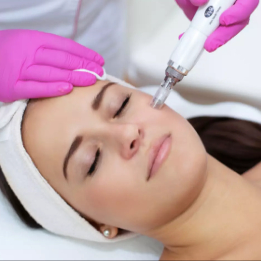Mikrojehličkování / mezoterapie obličeje