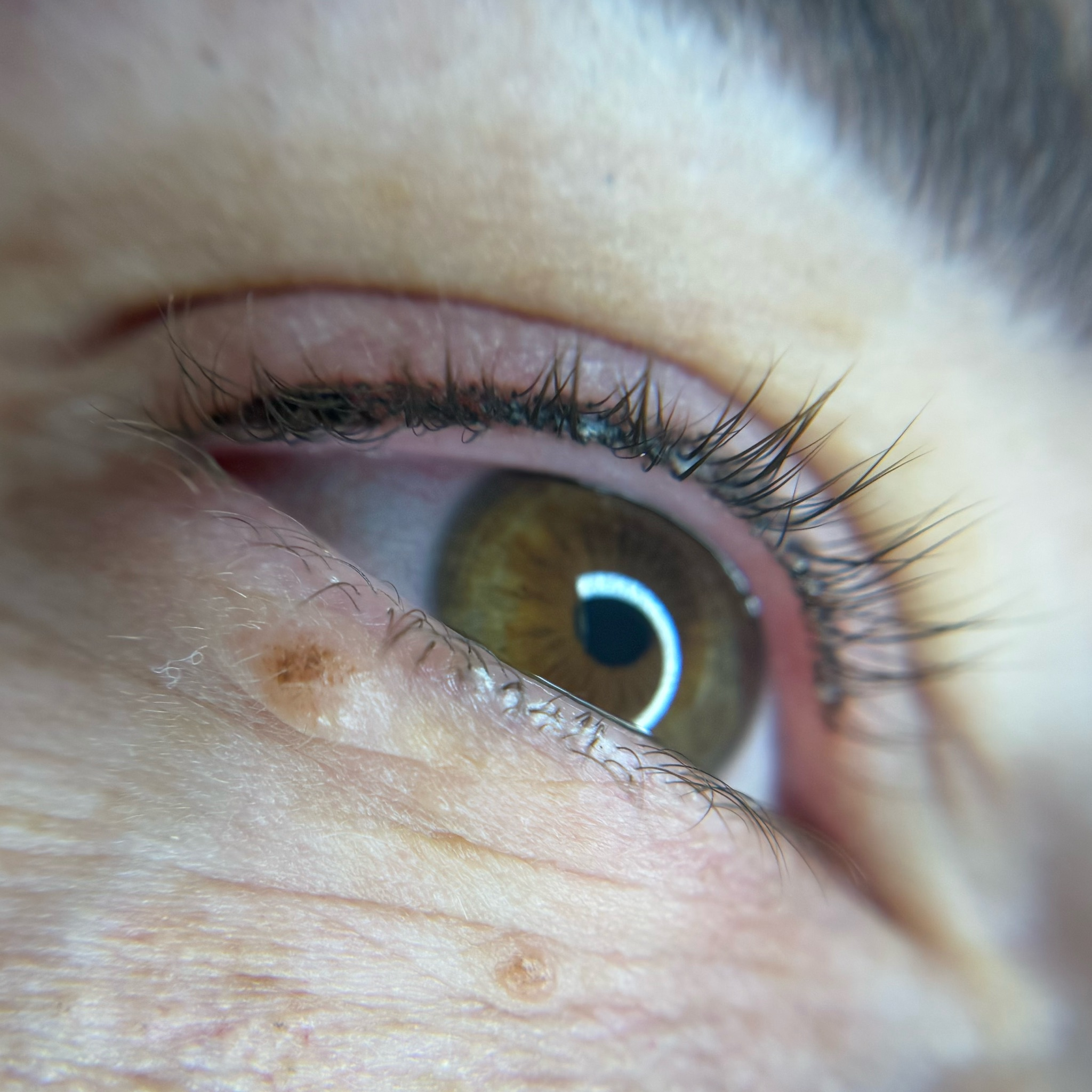 Meziřasové linky- 4000,-