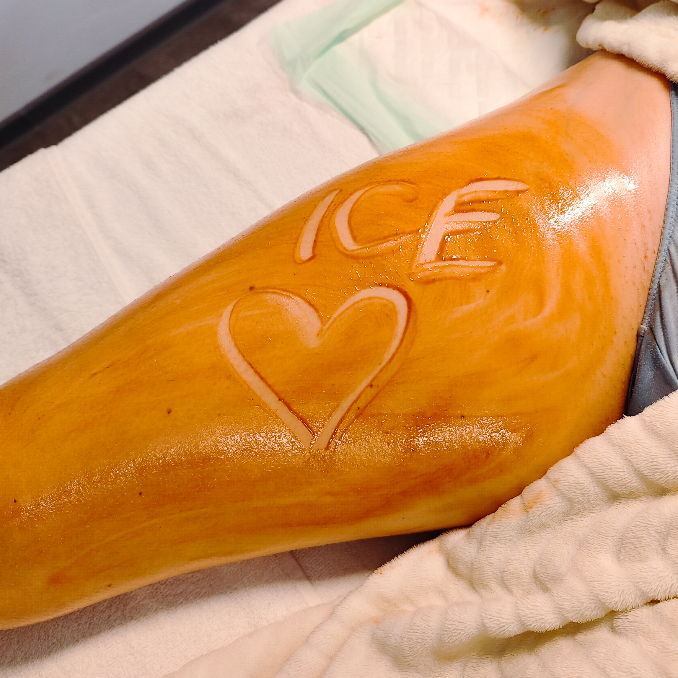 Ice Maderoterapie: Celé tělo