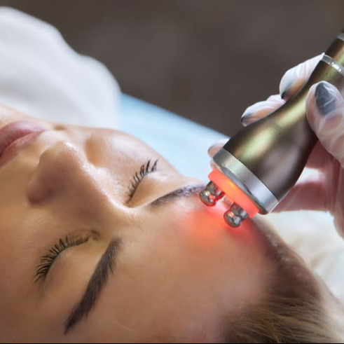 Radiofrecuencia Facial- Lifting , rejuvecimiento, anti- flacidez