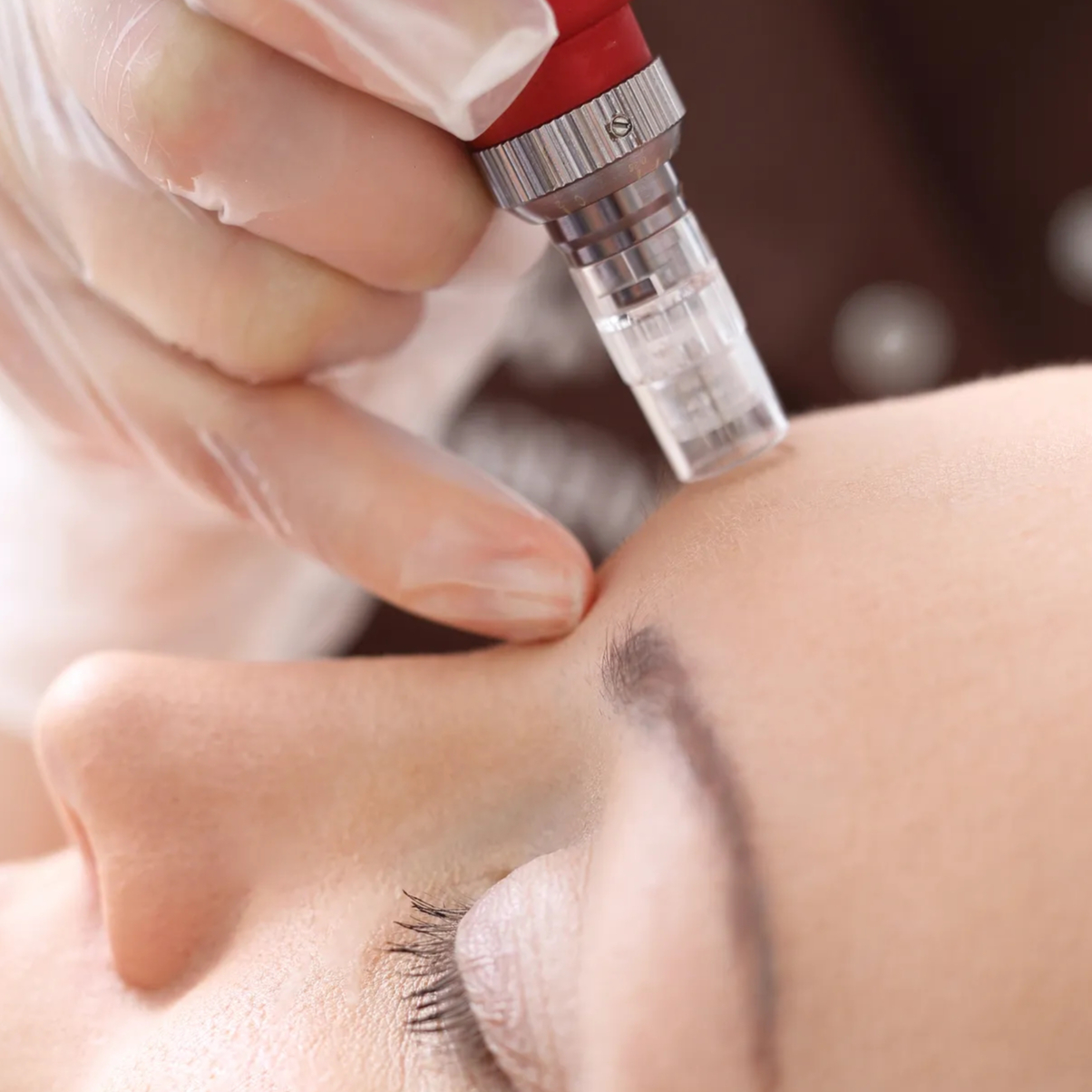 Mikrojehličkování (80 minut)