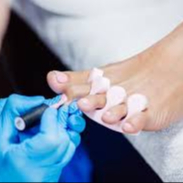 VSP Pieds : Pose sur ongles naturels