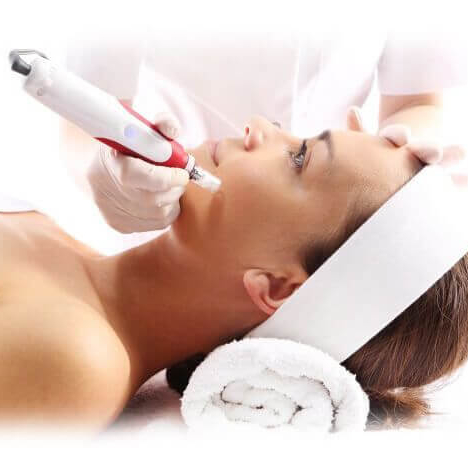 Mikrojehličkování ‑ obličej + krk 4 ošetření