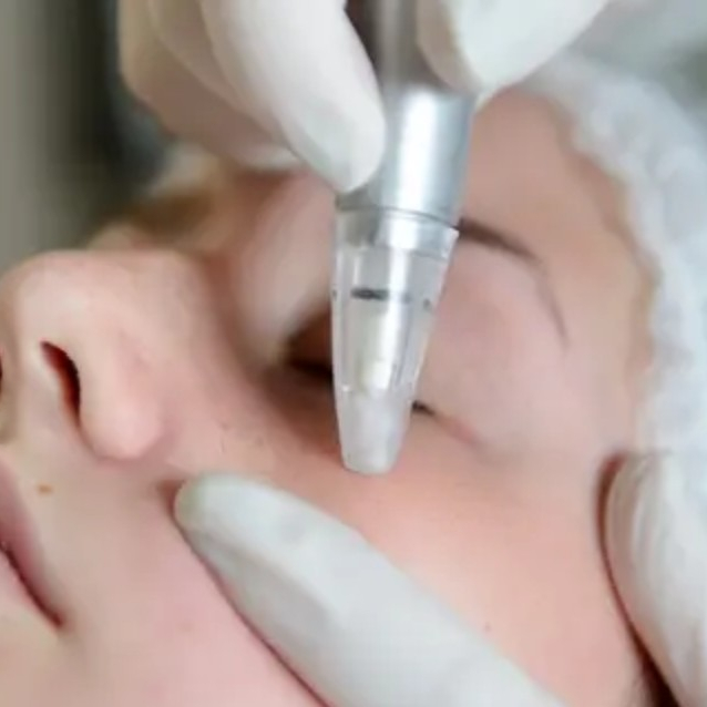 Mezoterapia - 2 strefy (twarz i szyja)