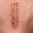 Plasma pen - mračivka