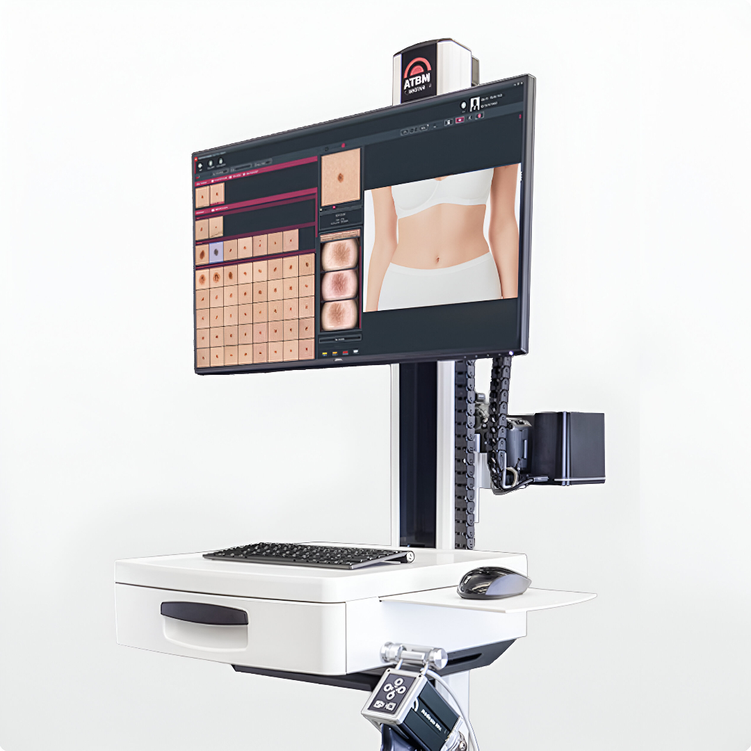 Lekár fyzicky prítomný - Celotelový sken znamienok