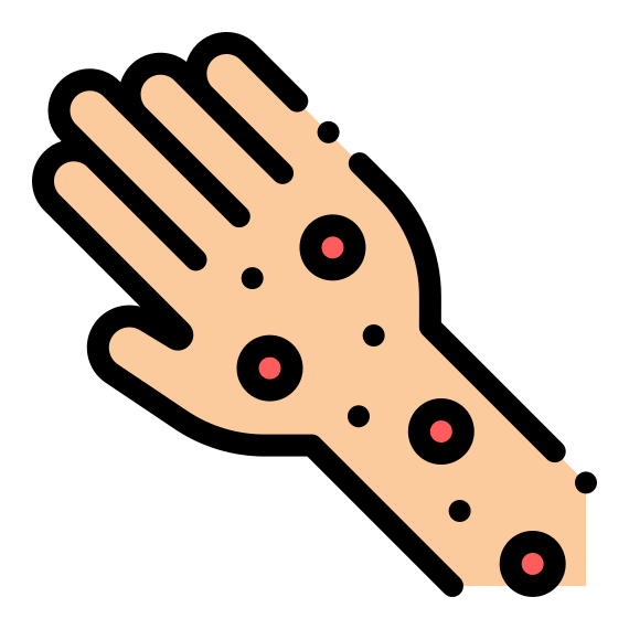 RAST Test Allergie