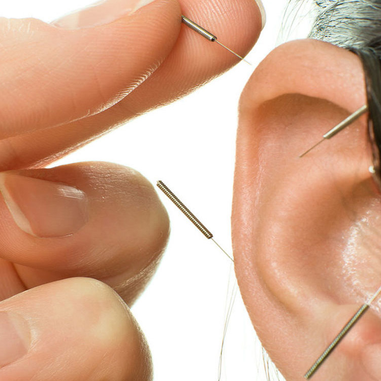 Fülakupunktúrás addiktológia