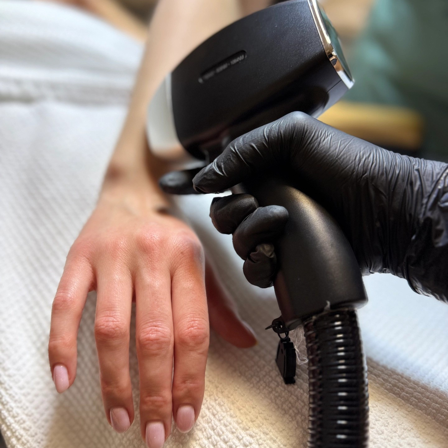 Předloktí - Laser / Forearm - Laser