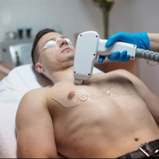 Depilação Laser SHR Tórax+Abdómen+Axilas+ Costas (Homem)