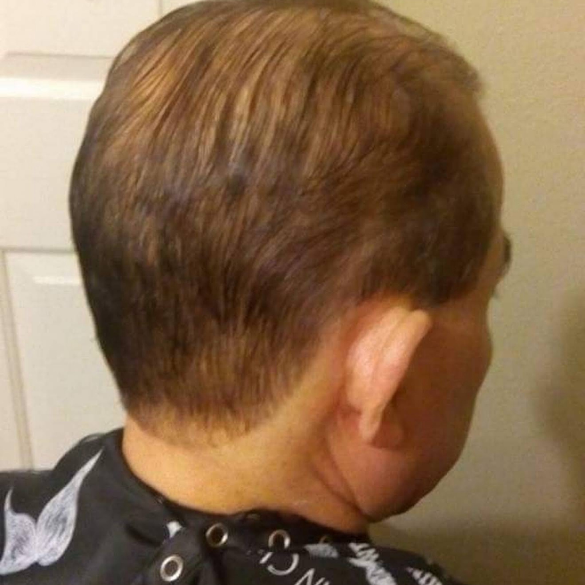 i9.Disminución con la dos ,corte normal o clásico