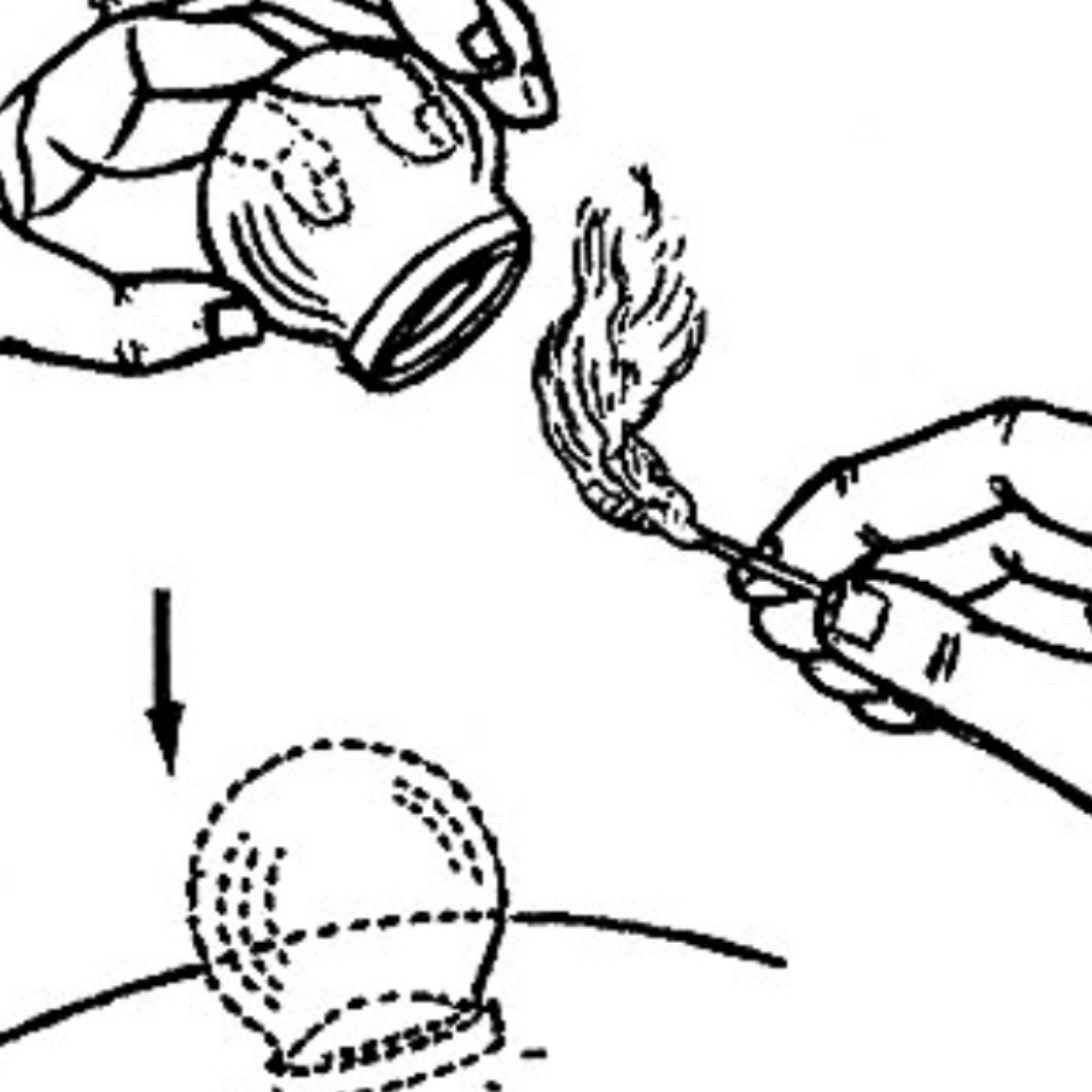Chinese Vacuum Cupping