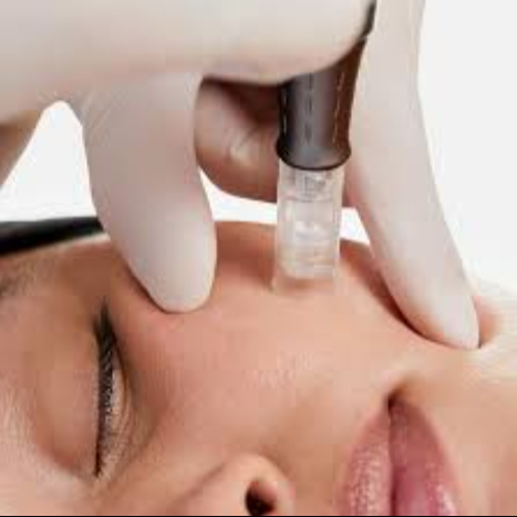 biorevitalizace - mikrojehličkování, microneedling