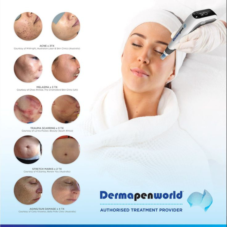 Balíček 3x ošetření Dermapen 4™ treatment