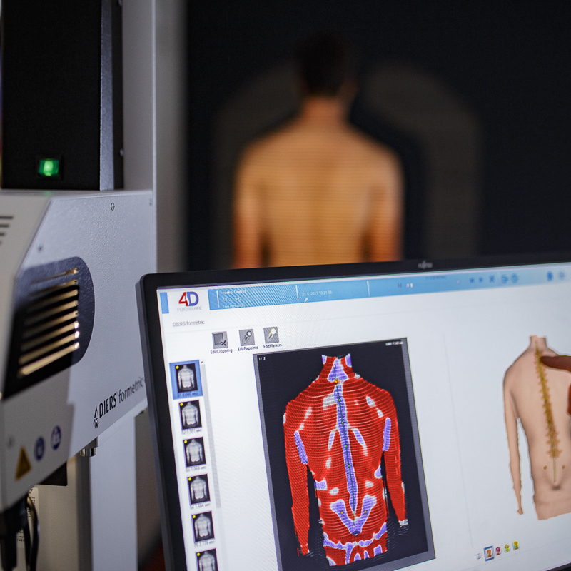 Vstupní konzultace s fyzioterapeutem + Formetric 4D + Matscan