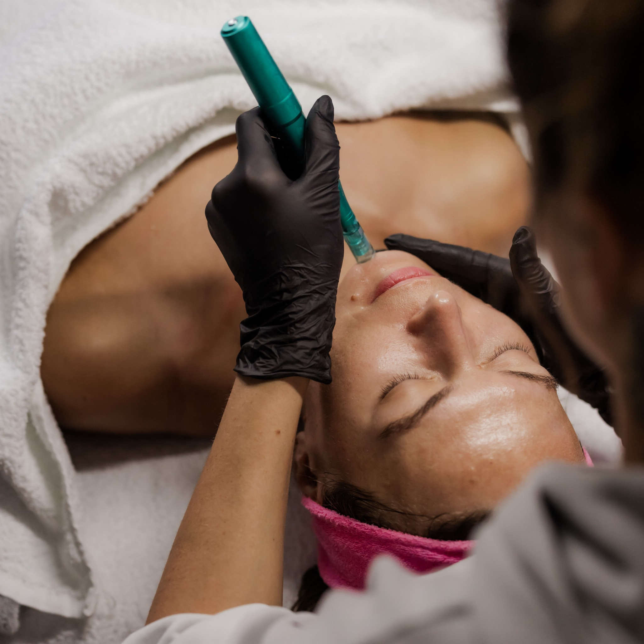 Mikrojehličky obličej