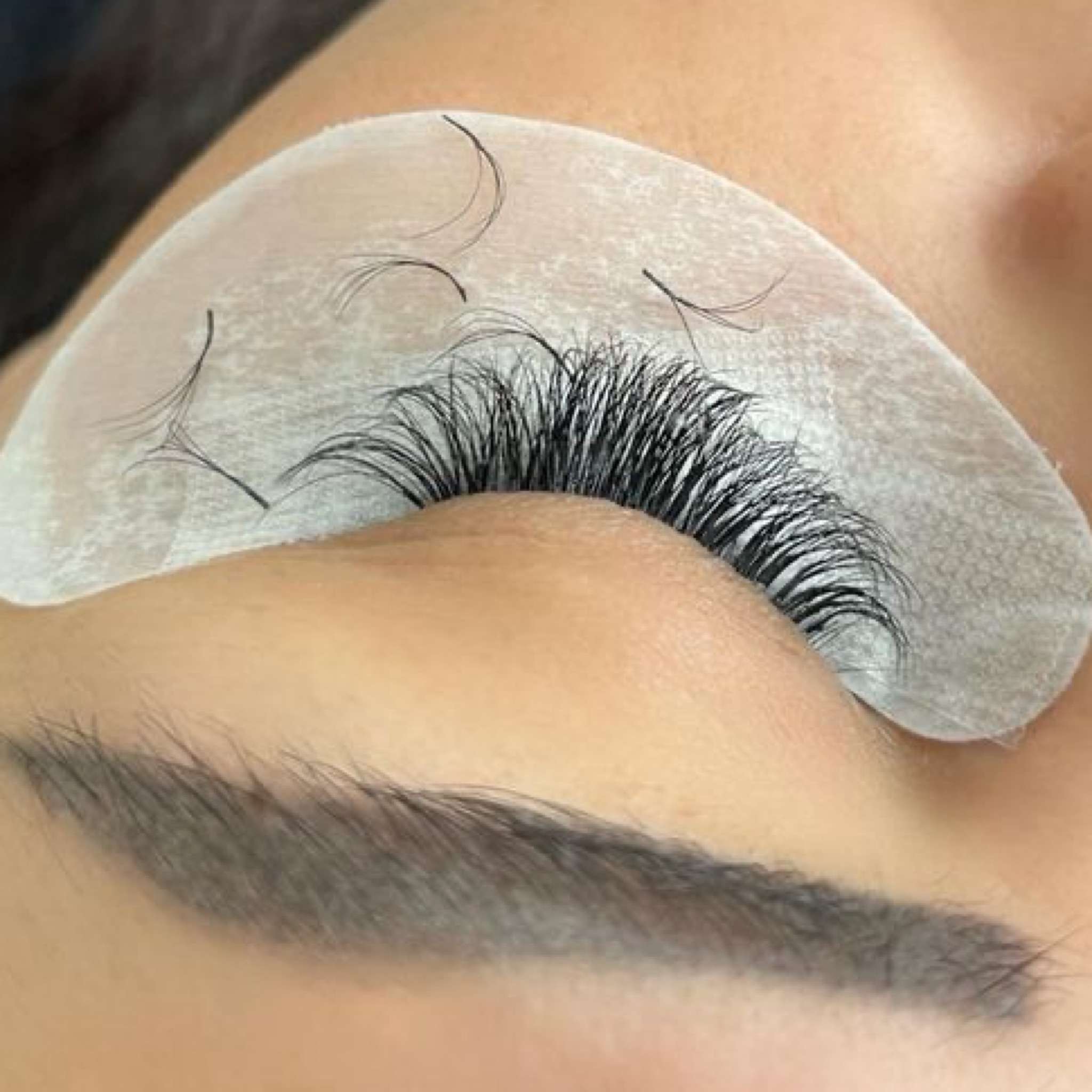 Dépose + pose mixte