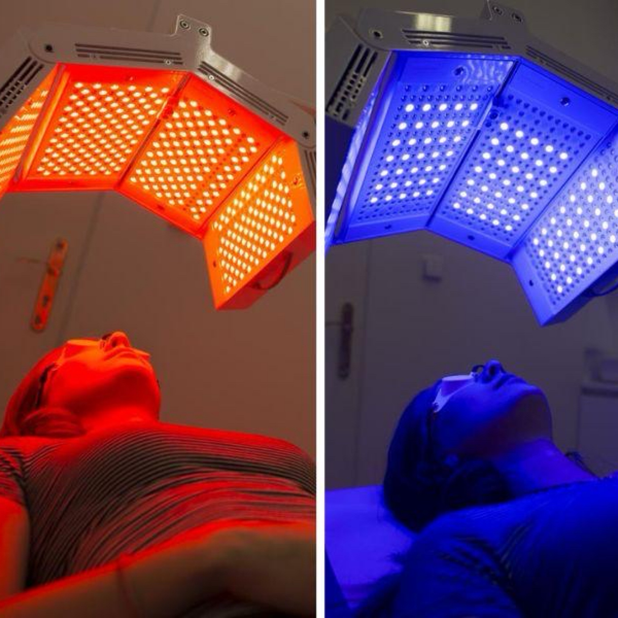 LED Ošetření 20 min + maska, dle aktuální potřeby pleti