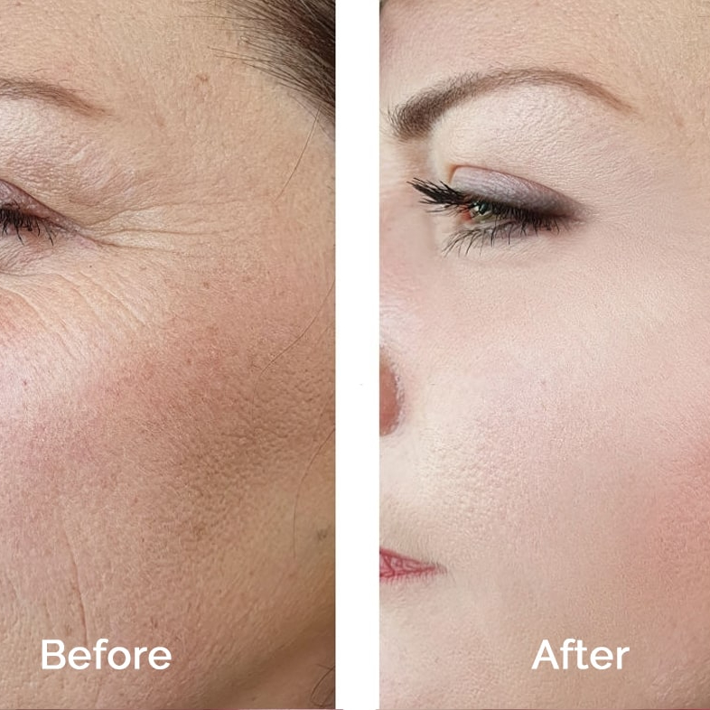 Wonderlift Collagène visage complet