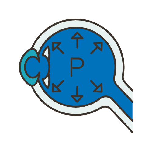 Měření nitroočního tlaku