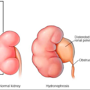 Visita Nefrologica di controllo