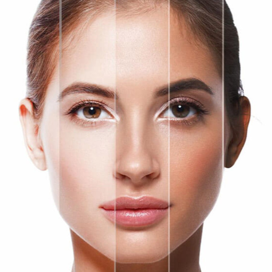 SMART sessão solario+colagéneo 24M