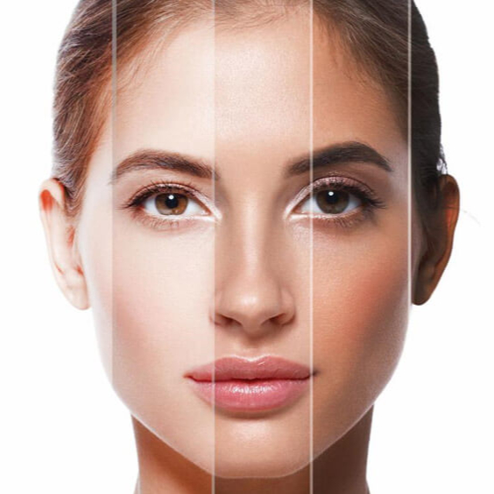 SMART sessão solario+colagéneo 08M