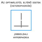 Polateszt Vizsgálat