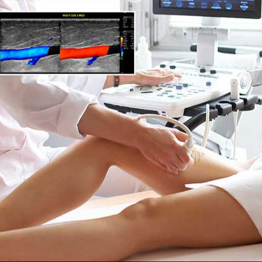 Doppler Arterioso Arti