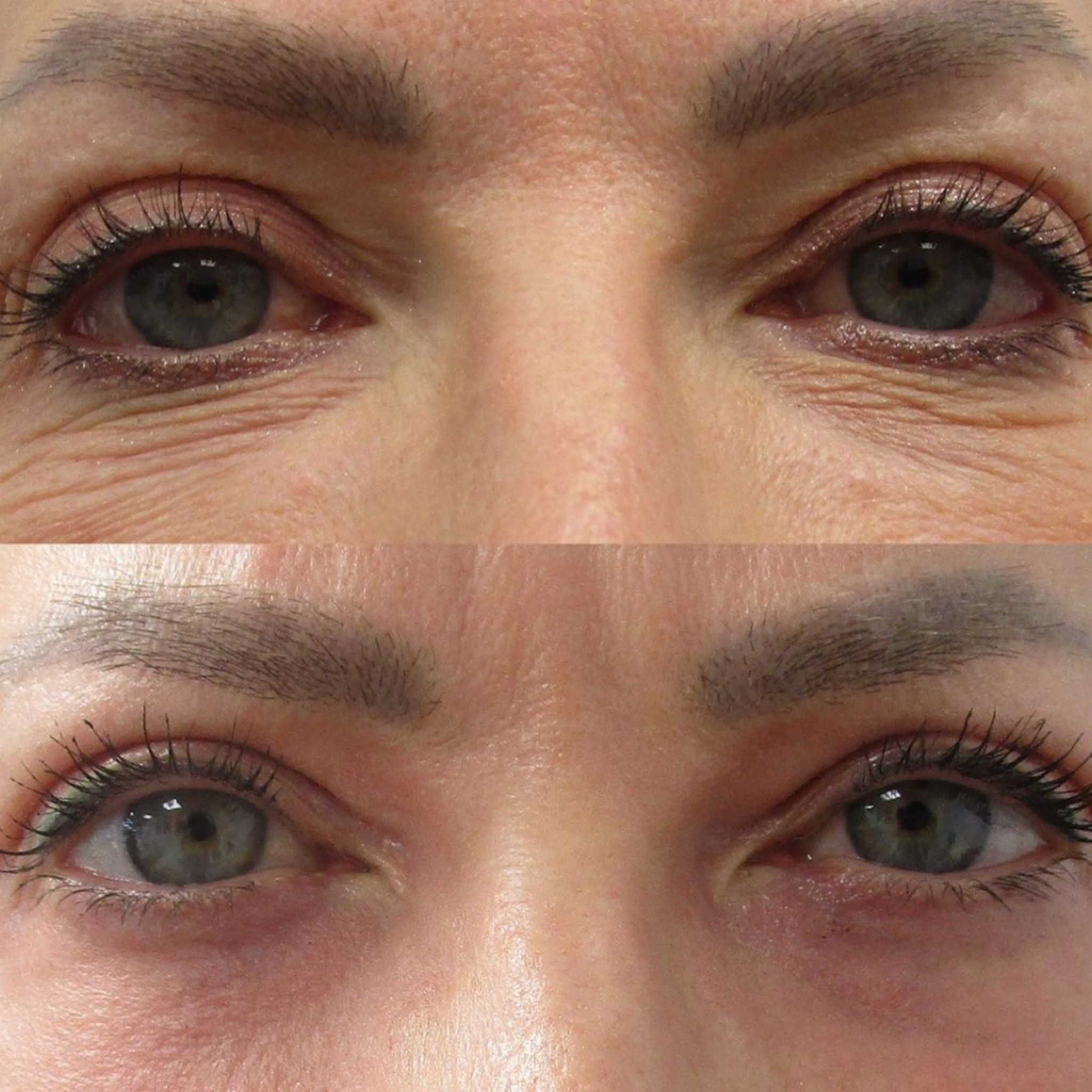 TRATAMIENTO "PERFECT EYES "