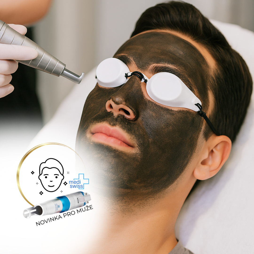 KARBONOVÝ PEELING PRO MUŽE - (obličej)