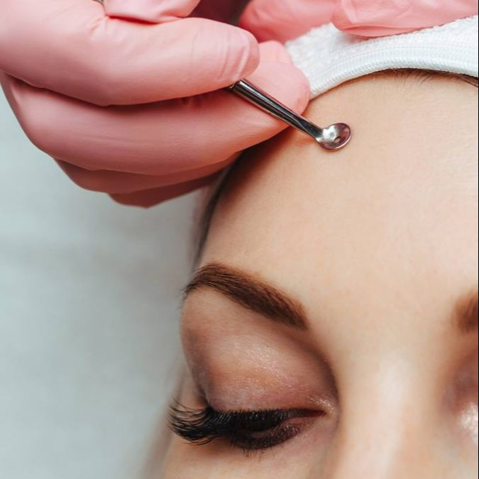 Hloubkové čištění obličeje s chemickým peelingem