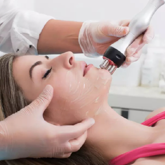 Radiofrekvence obličeje - lifting