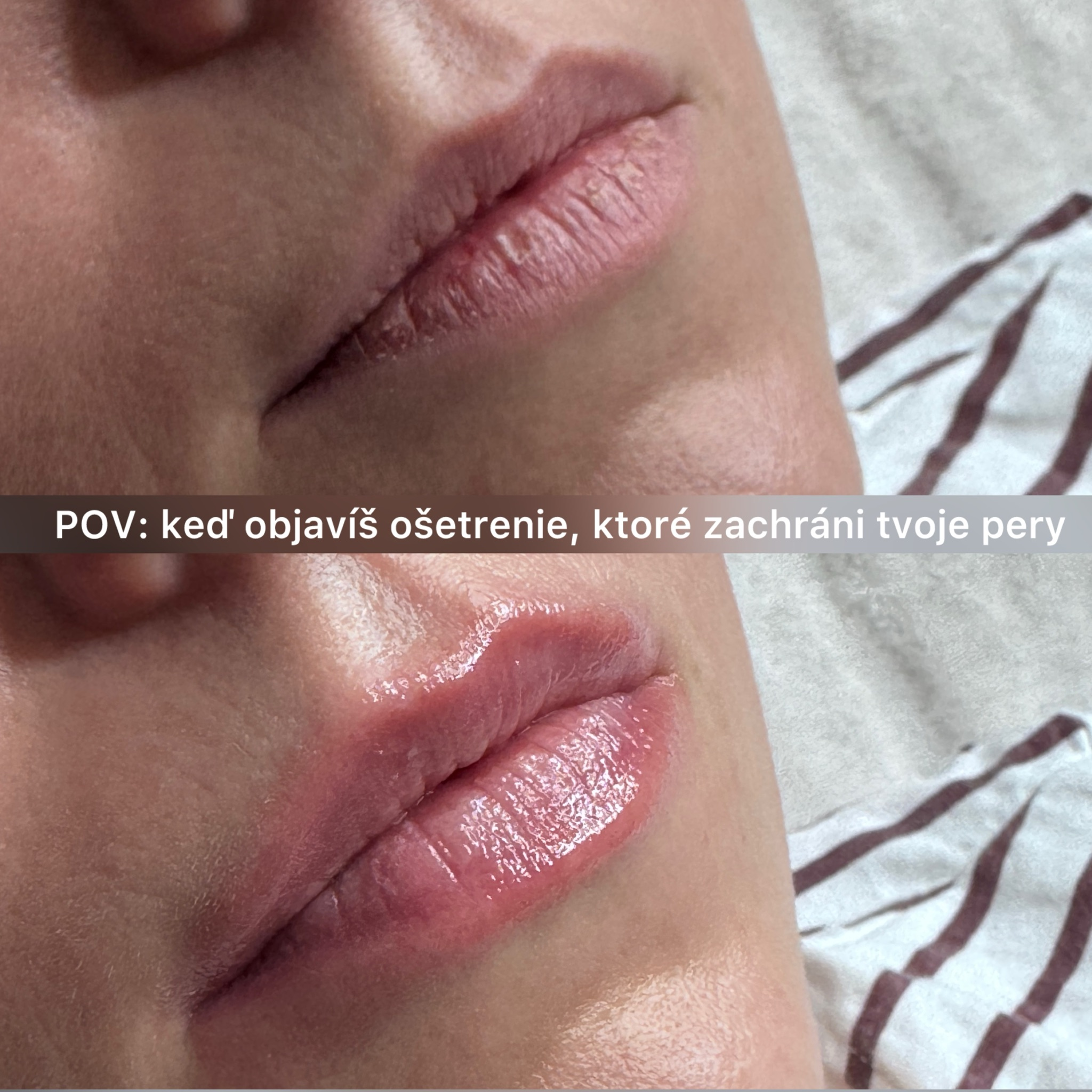 Omladenie a hydratácia pier