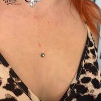 Microdermal