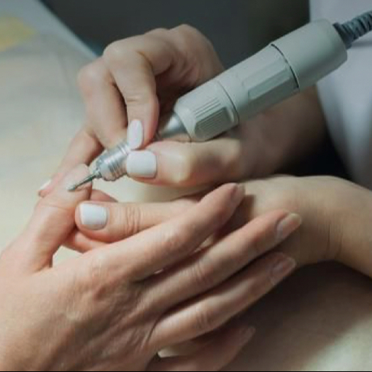 Dépose gel