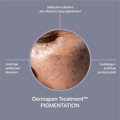 Dermapen Treatment™ Pigmentation