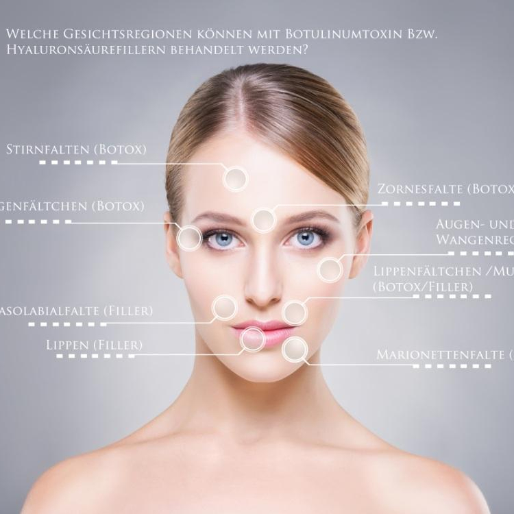 Botox Kombination (Stirn, Zornesfalte, Krähenfüsse)
