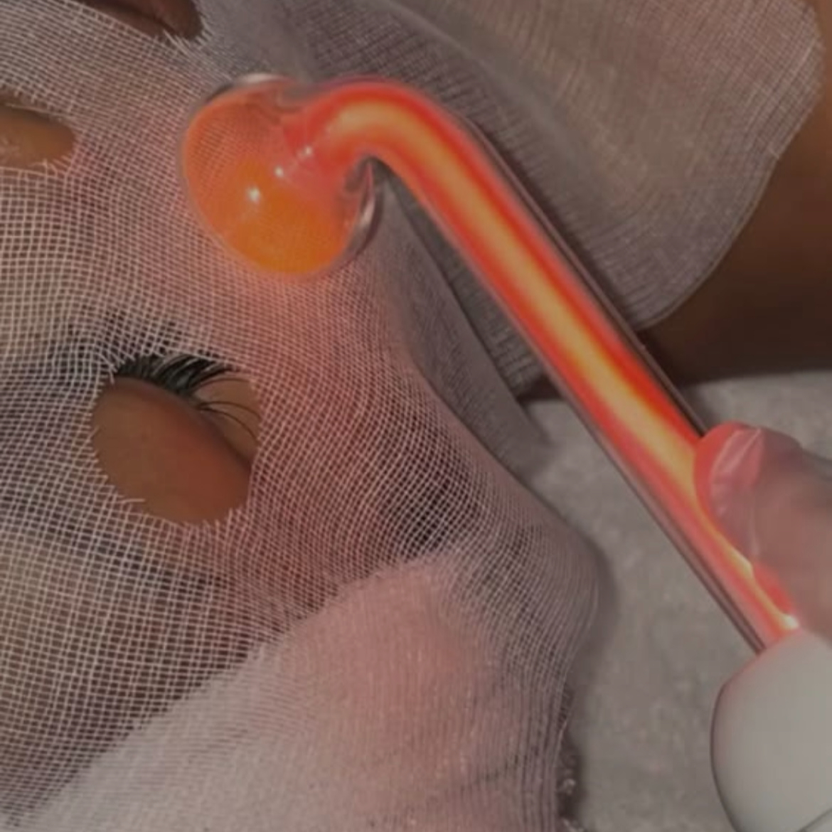 Vysoká frekvence + ozonizér + plazma