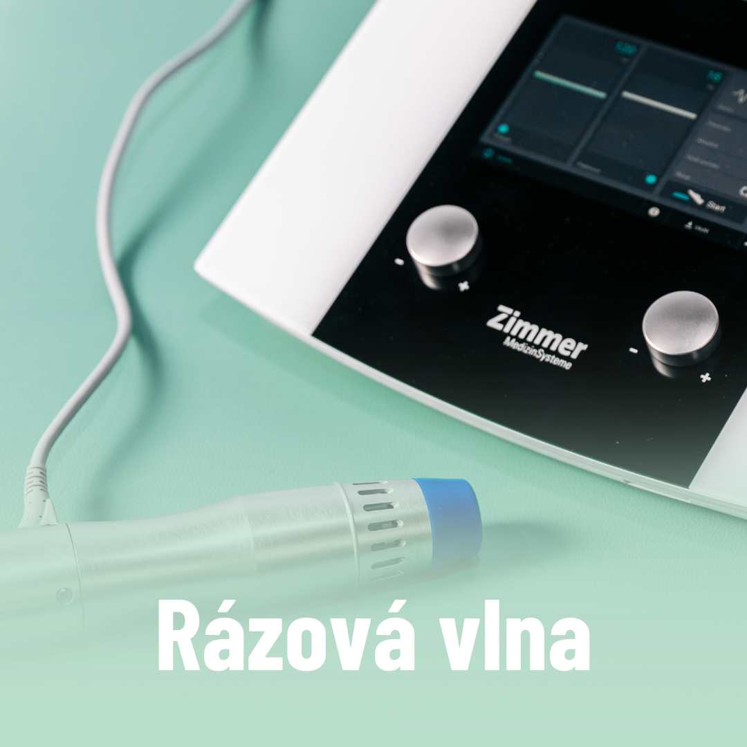 Rázová vlna