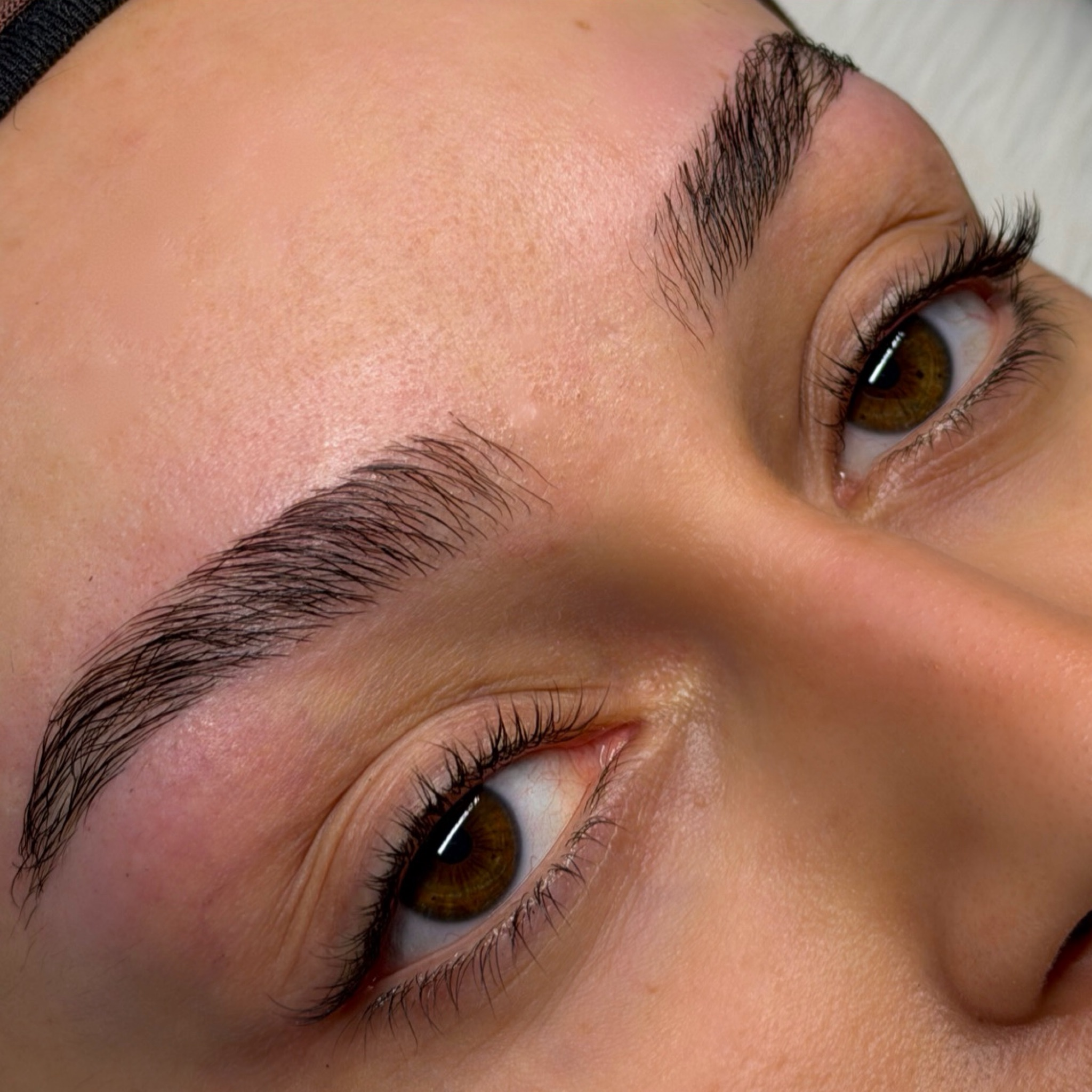 Browlift + restructuration