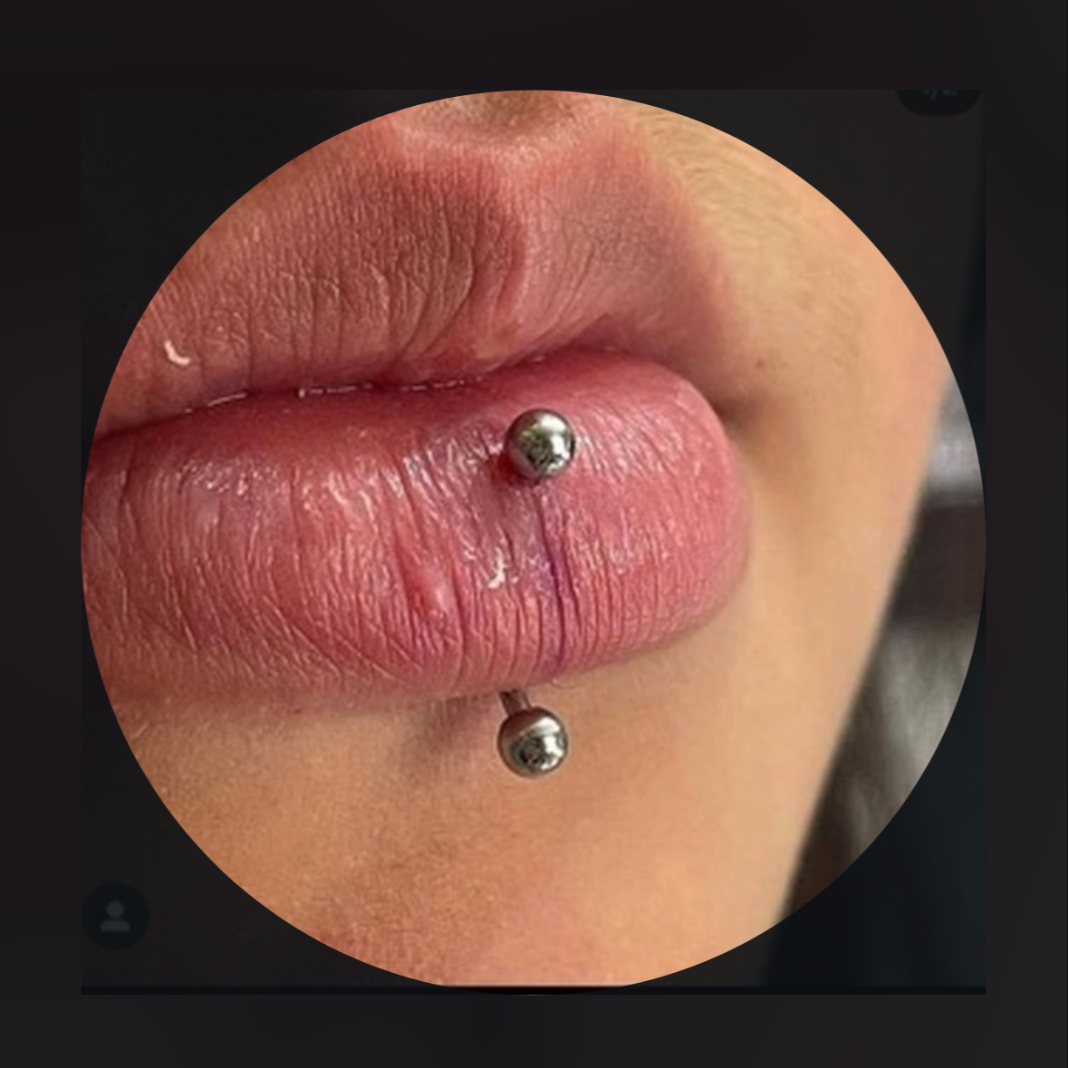 Labret vertical