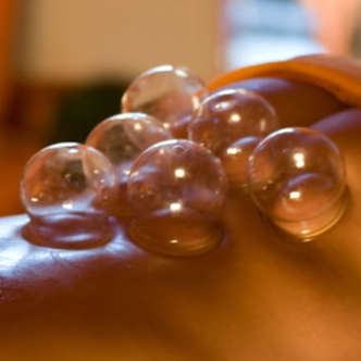 Baňková masáž 60min