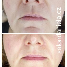 MY SECRET zralá a náročná 40+ ..omlazení..1500,-