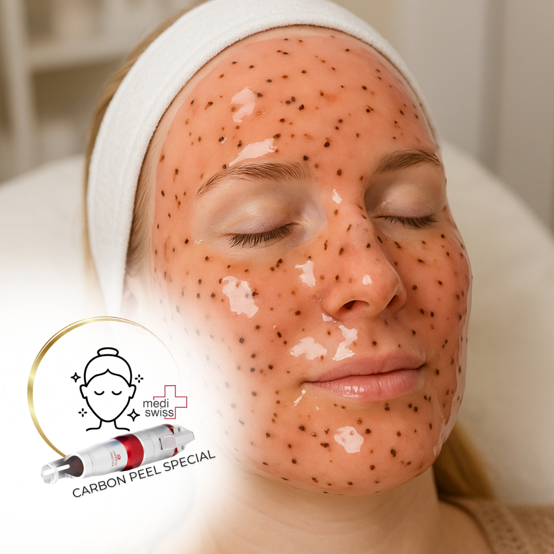 KARBONOVÝ PEELING SPECIAL - (obličej+krk+dekolt)