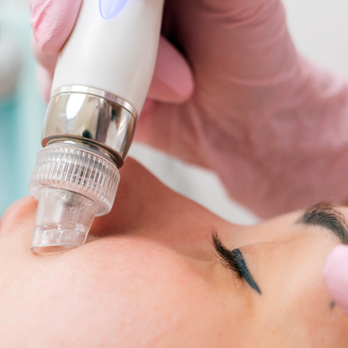 Aquabrasia čistenie tváre / Aquabrasio arctisztítás