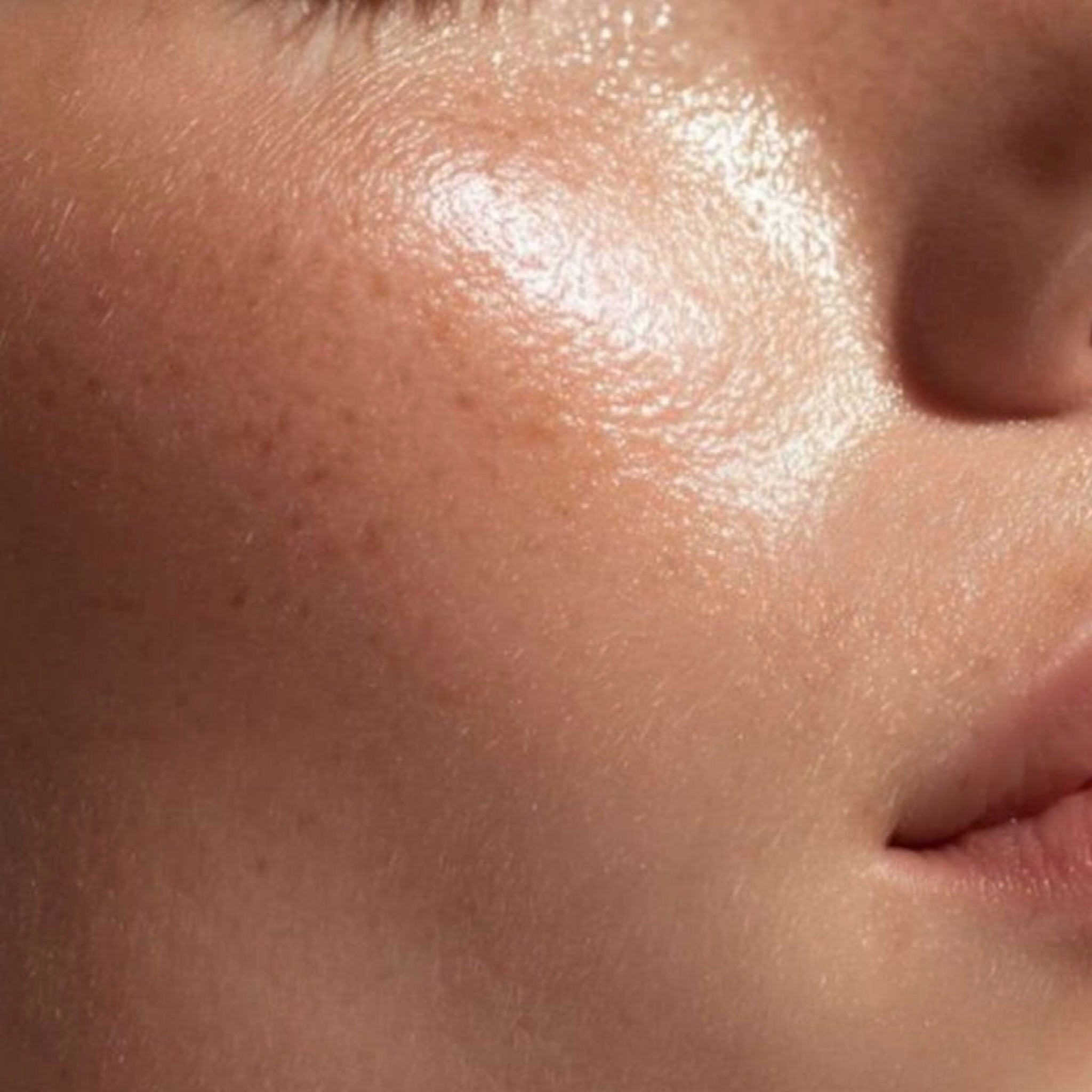 Esthe Filler – Pre stratenú pevnosť a jas pleti