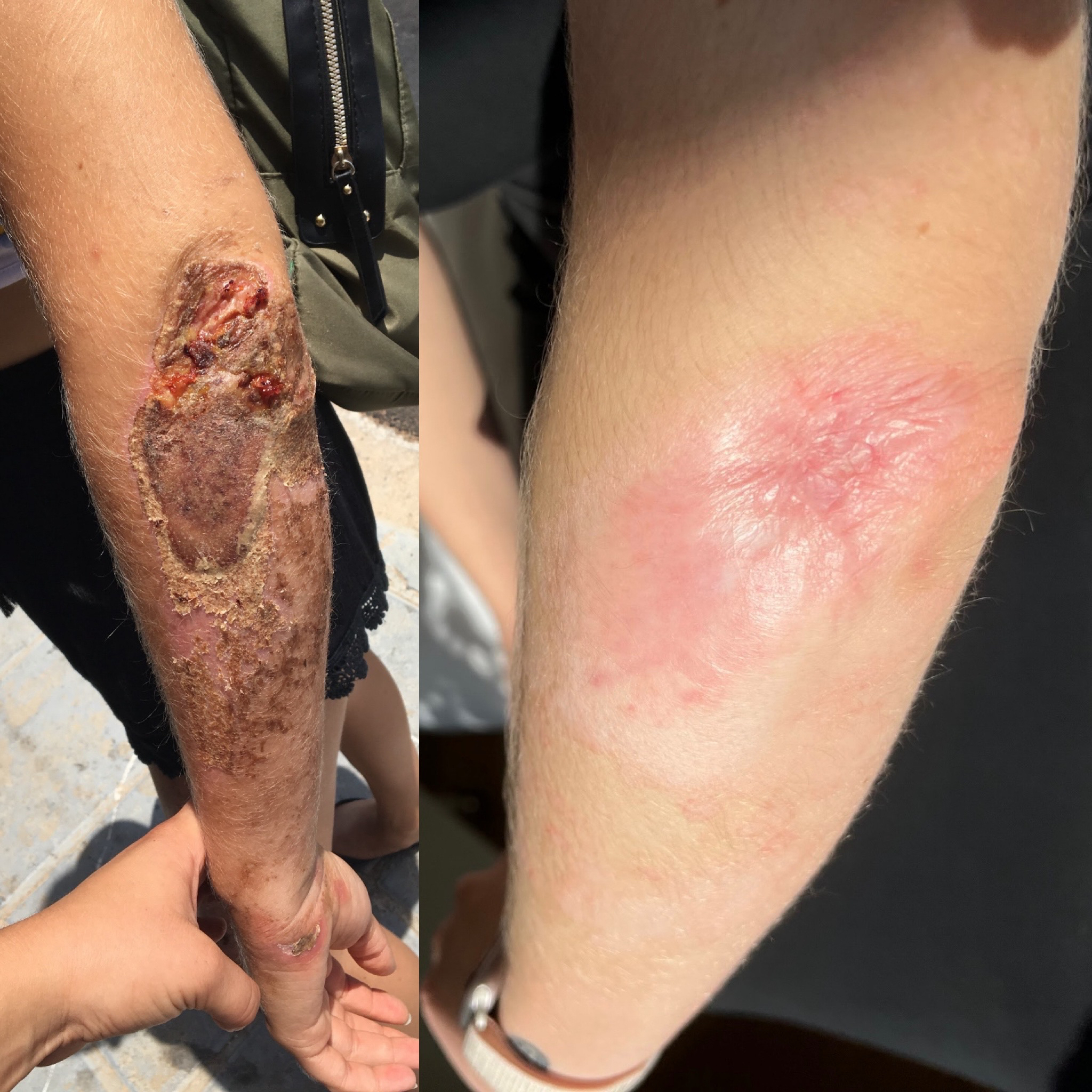 Jazva - konzultácia