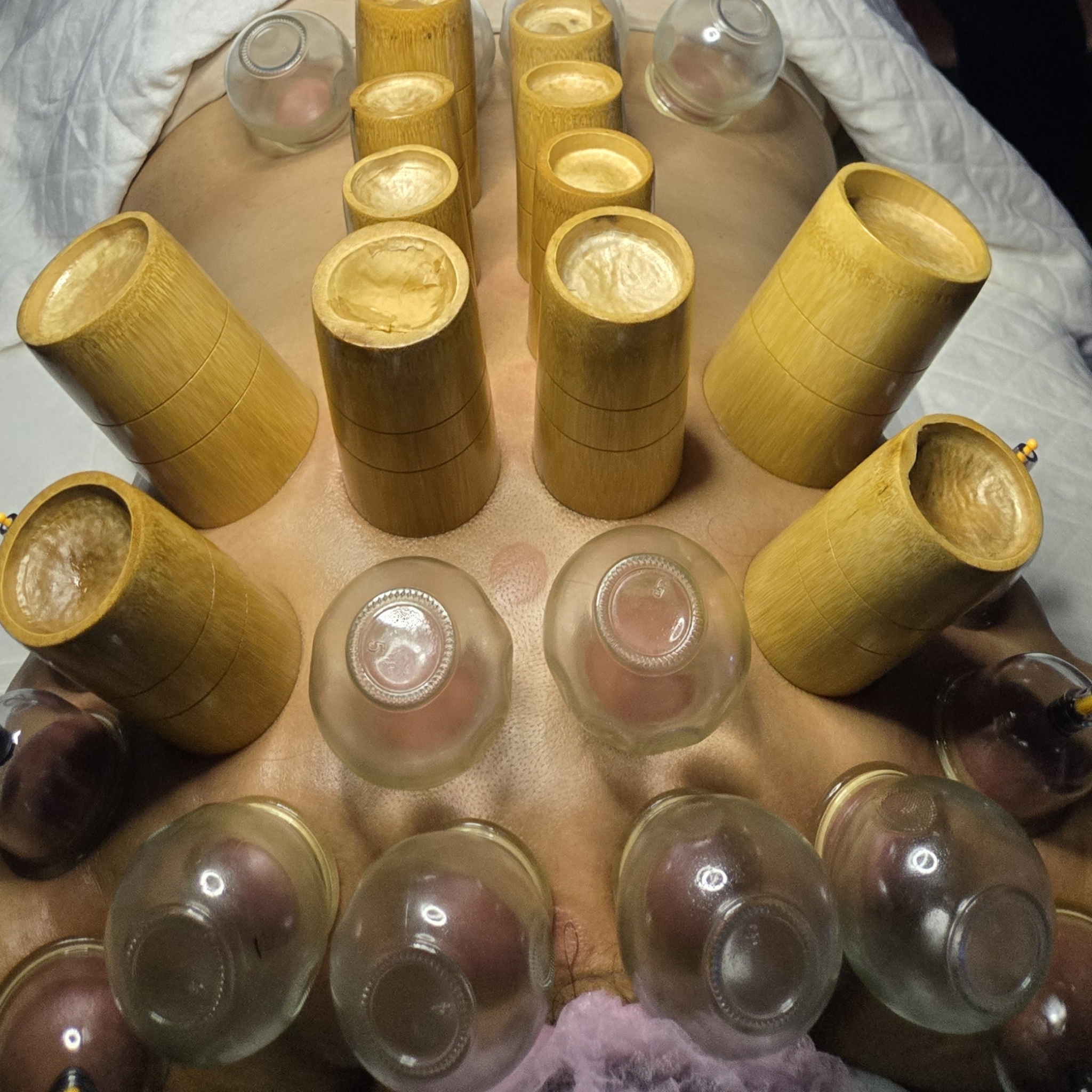 Hijama CHAUDE DOS complet